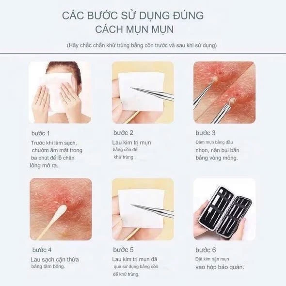 Sét Dụng Cụ Nặn Mụn JPNK Pro
